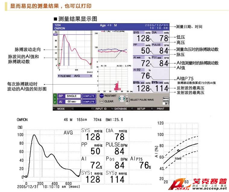 顯而易見(jiàn)的動(dòng)脈結(jié)果