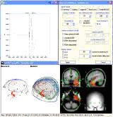 Neuroscan Source v2 TM溯源分析定位軟件